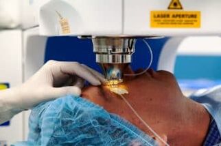 Cirurgia de visão a laser