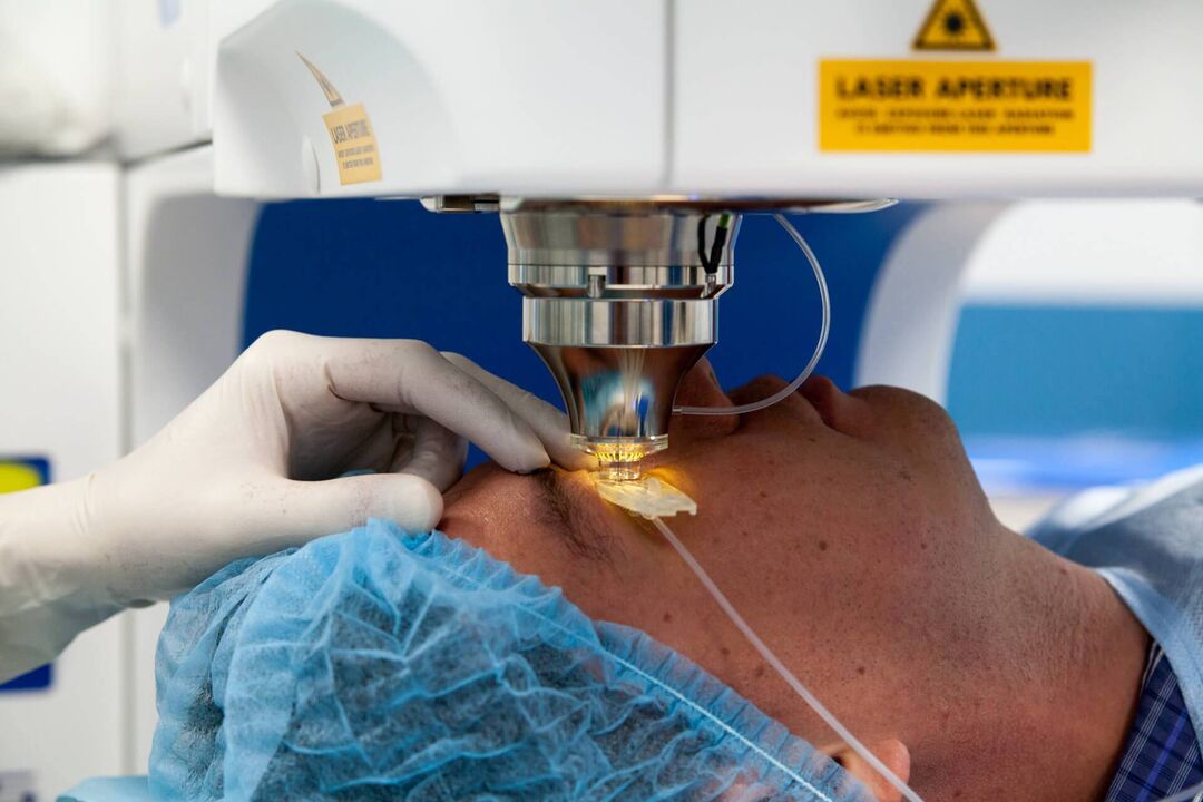 cirurgia a laser para restaurar a visão